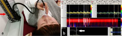 说明: D:\无需解密\新闻上传\2017\4.18\王思博 咳嗽文章 plos one.jpg