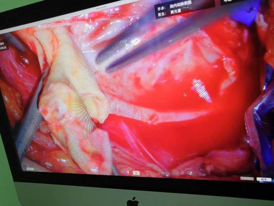 说明: https://mmbiz.qpic.cn/mmbiz_jpg/HtNzBE0PDIU0edquboMH7iazYmwakNPCbibk3ticUMHlLgYVpLPibkg2bnQzsEklKbnTEV0xuGDDXu8sGwxf7VXWbQ/640?wx_fmt=jpeg