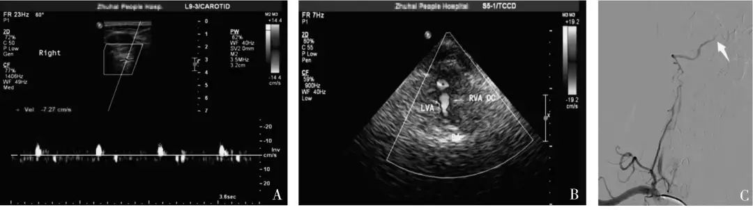 说明: https://mmbiz.qpic.cn/mmbiz_jpg/HtNzBE0PDIUf37YvkPiad4F3iaOQG4MA7I99j9zdC4N6qbK8FcCsbRCx7Yia4YL5e29JA7ibalZq84dW0F77pSWNhA/640?wx_fmt=jpeg